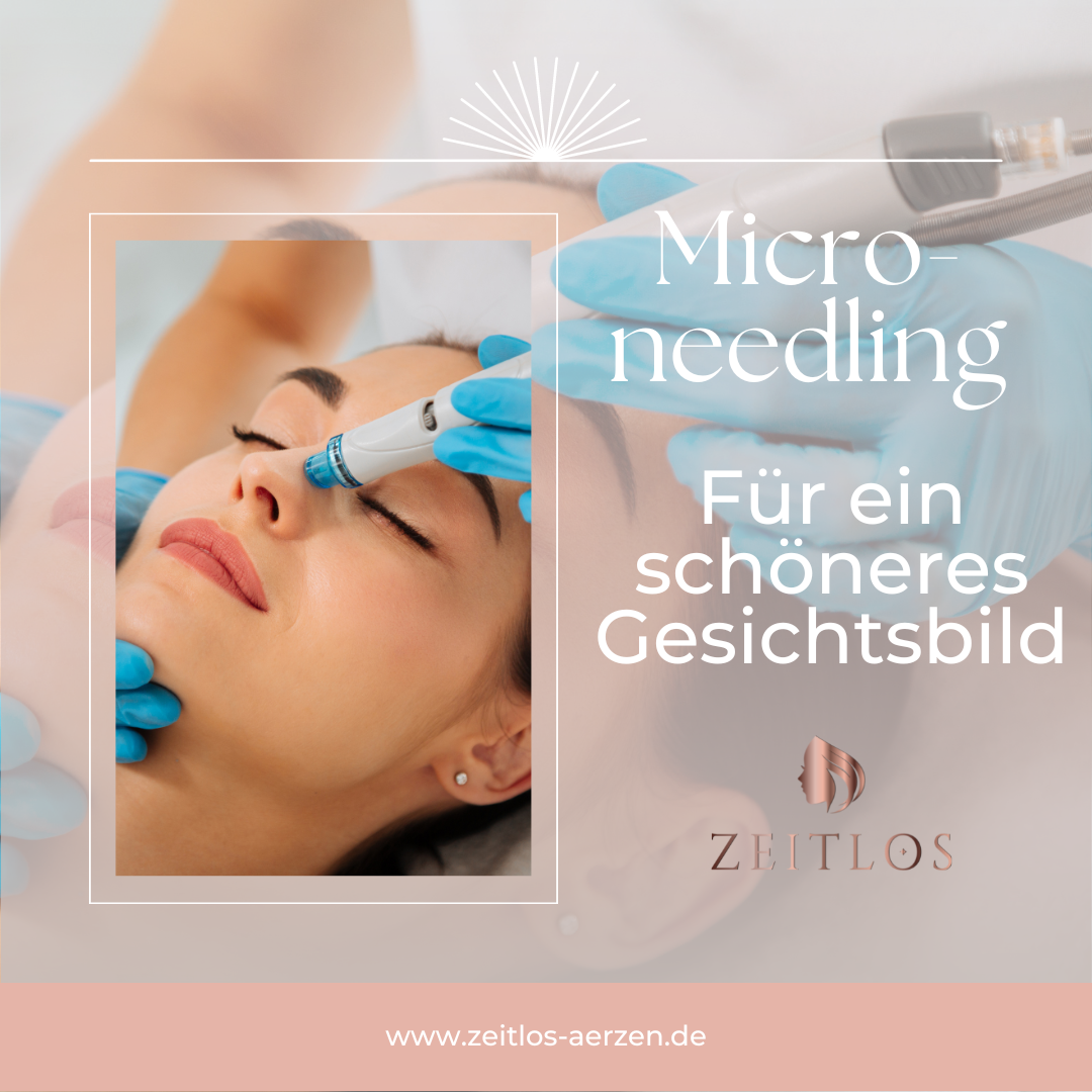 Microneedling in Aerzen